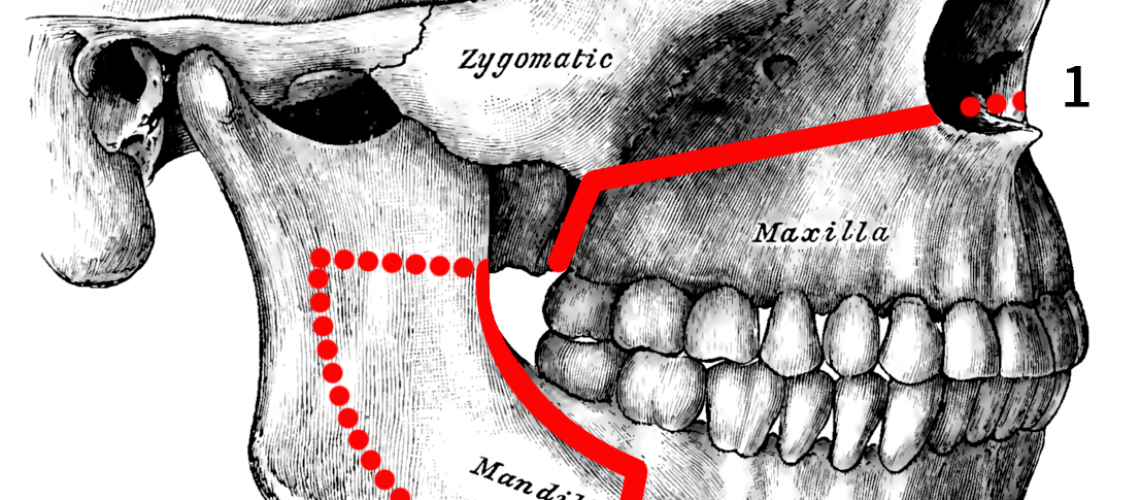 The Importance Of Details In Orthognathic Surgery